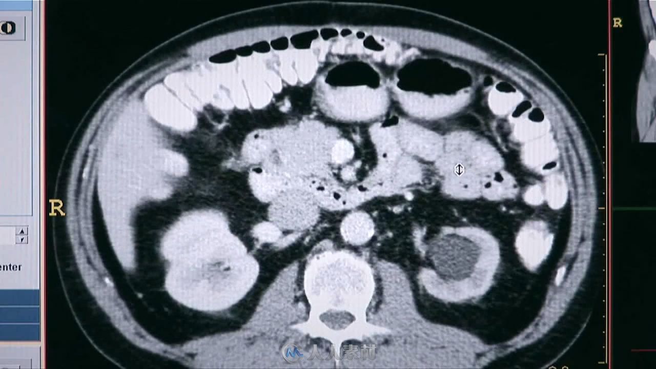 3组脑细胞快速生长 科学家研究医药医疗器械