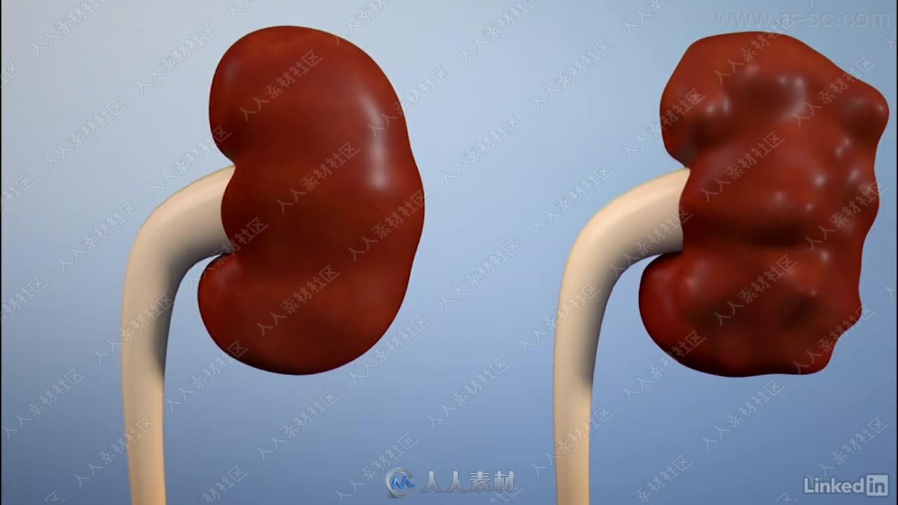 Maya医学解剖医疗动画基础训练视频教程