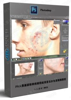 PS人像面部粉刺疤痕瑕疵美容去除处理视频教程