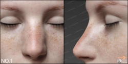 雀斑脸颊多组不同形态鼻子3D模型